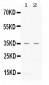 Anti-CXCL16 Picoband Antibody